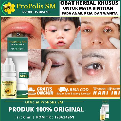 Obat Sakit Mata Bintitan Homecare24