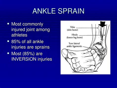 Ppt Foot And Ankle Complaints Powerpoint Presentation Free Download