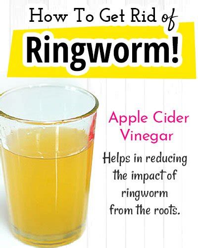 Cleanse Ringworm Patches With The Best Of Home Remedies