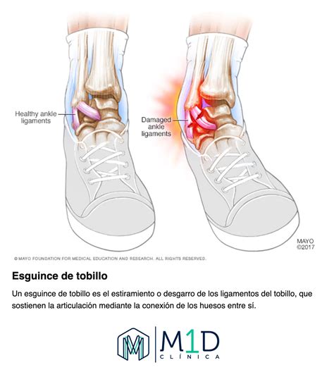 Lesiones De Tobillo Y Pie M1d Clínica