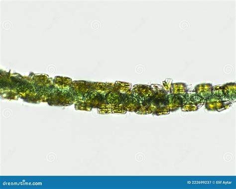 Blue Green Filamentous Algae Under Microscopic View Cyanobacteria