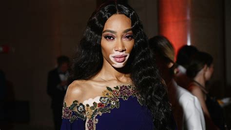 Winnie Harlow Is The First Sports Illustrated Swimsuit Model With