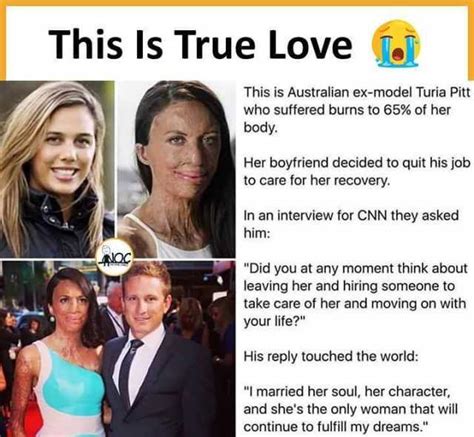 This Is True Love To This Is Australian Ex Model Turia Pitt Who Suffered Burns To Of Her