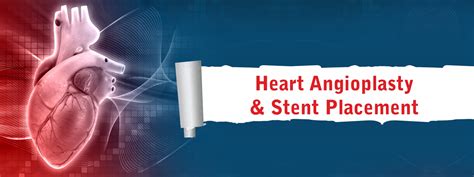 Angioplasty Stent Placement Procedure For Heart Amandeep Hospital