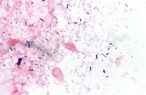 Image Giardia Psittaci Gram Stain Parakeet Small Intestine Msd