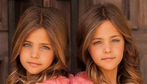 these twins were named “most beautiful in the world ” wait till you see them today