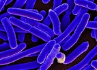 Here's how E. coli infections spread from animals to people, and what ...