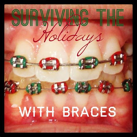 Surviving The Holidays With Braces The Braces Blog Northern