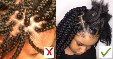 Massage your scalp to increase circulation. HOW TO GROW YOUR HAIRLINE BACK