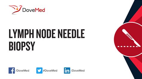 Fine Needle Aspiration Lymph Node Biopsy