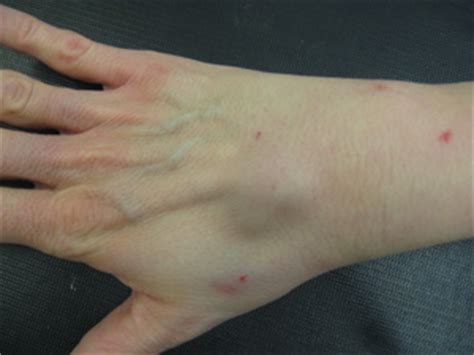 Hand 2 hand is the place to come. The Hand Clinic