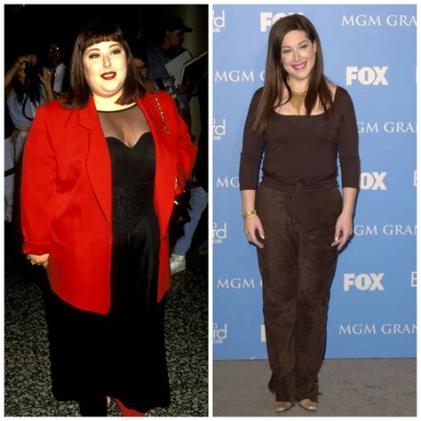 10 Celebrity Weight Loss Success Stories With Gastric Bypass Before And After Pictures