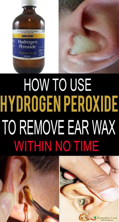 Leave the hydrogen peroxide in your ear for 20 minutes. How To Use Hydrogen Peroxide To Remove Ear Wax | Ear wax ...