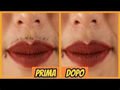 See more of la brianza senza sopracciglia on facebook. Come ELIMINARE i BAFFETTI senza ceretta ♡ - YouTube nel ...