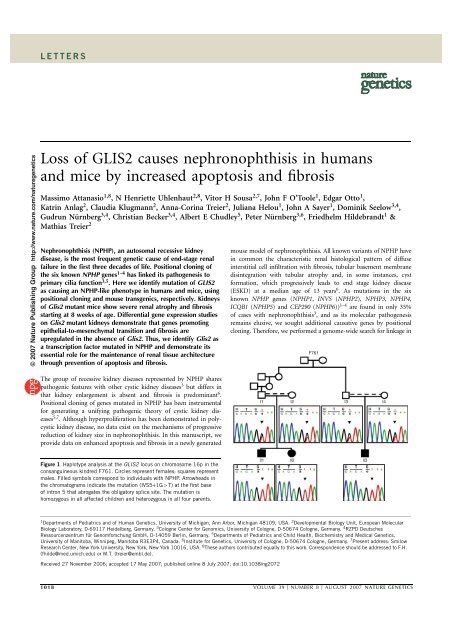 Loss Of Glis2 Causes Nephronophthisis In Humans And Mice Mdc