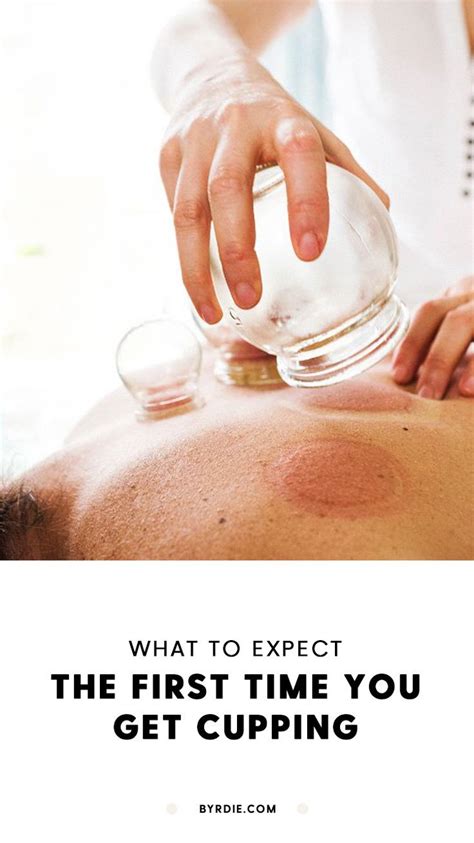 Heres What To Expect The First Time You Get Cupping Cupping Therapy What Is Cupping Therapy