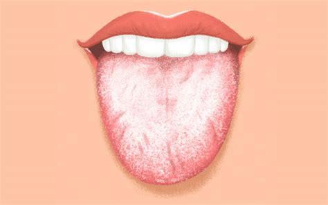 This Is What Your Tongue Can Say About Your Health Health Advice Page 4