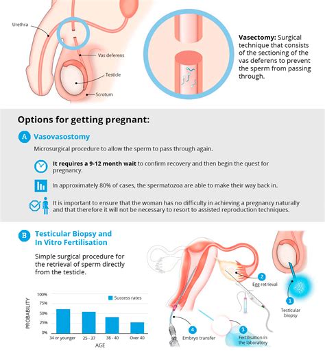 After Vasectomy Sperm Retrieval Telegraph