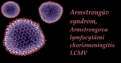 Armstrongův Syndrom Armstrongova Lymfocytární Choriomeningitis Lcmv
