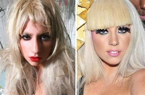 Lady Gaga Plastic Surgery Before And After Photos Lady Gaga Nose Lady Gaga Plastic Surgery