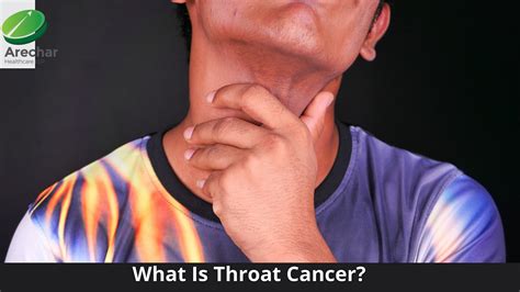 What Is Throat Cancer Throat Cancer Causes Signs Treatment By