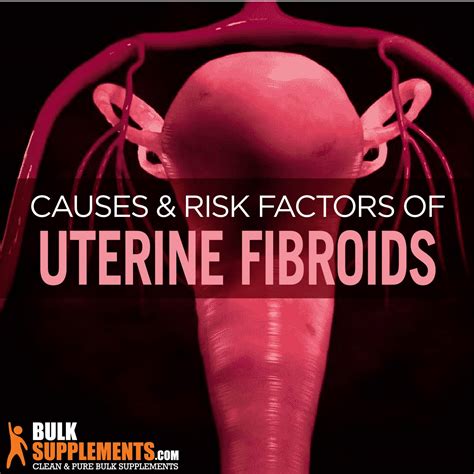 Uterine Fibroids Symptoms Causes And Treatment By James Denlinger