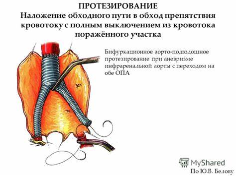 Диета при венозной недостаточности