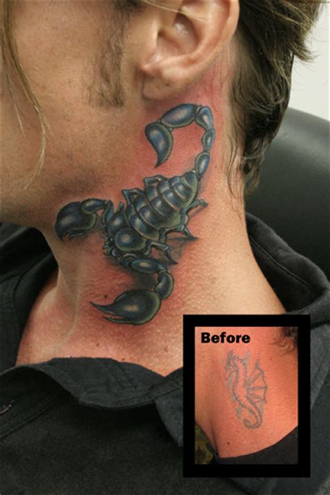 Tatuagem Escorpião Pescoço Cobertura Por Seoul Ink Tattoo