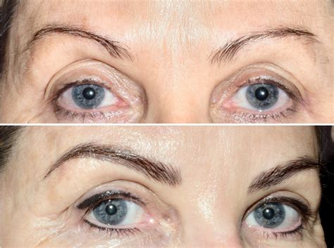 Cosmetic Tattoo Clinic Sunshine Coast | Gallery Eyebrow Tattoo It promises bolder brows with a natural appearance ts a small, handheld tool topped off with microneedles, which deposit pigment.