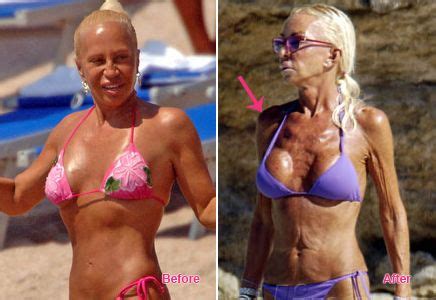 Chatter Busy Donatella Versace Before Plastic Surgery Donatella Versace Plastic Surgery