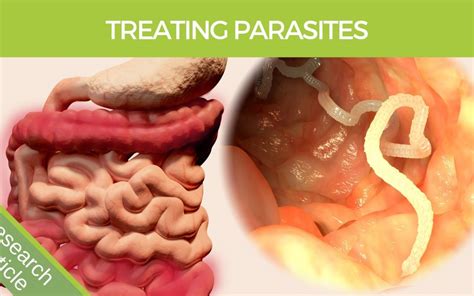 Most Effective Parasite Cleansing Program And Home Remedies
