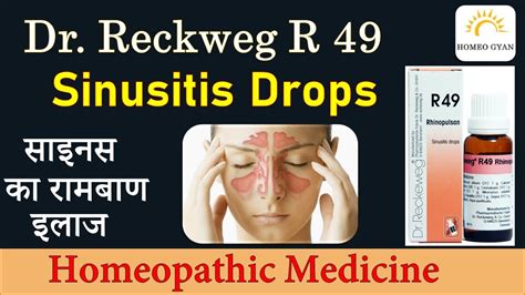Homeopathy For Sinusitis Sinusitis Treatment R49 Homeopathic
