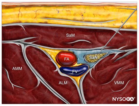 Ultrasound Guided Saphenous Adductor Canal Block Nysora