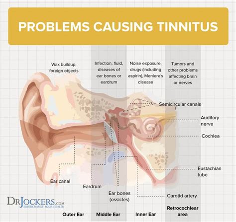 Tinnitus Symptoms Causes And Natural Support Strategies Tinnitus