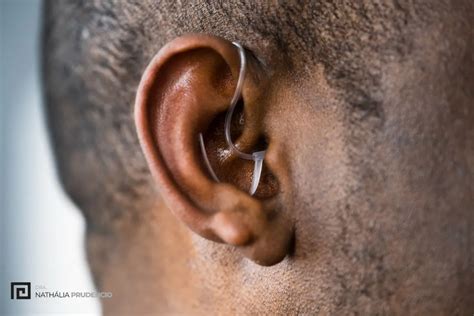 Como Tratar O Zumbido No Ouvido Os 10 Principais Tratamentos