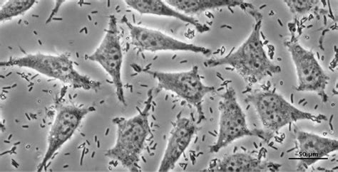 Mycoplasma Contamination In Cell Culture