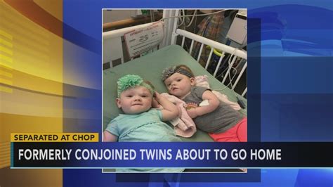 Formerly Conjoined Twins Almost Ready For Home After Chop Surgery