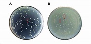 | Changes of colony morphology of E. coli O157:H7 induced by low ...