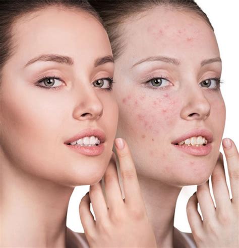 How To Do Skin Care For Sensitive Skin Tasteful Space