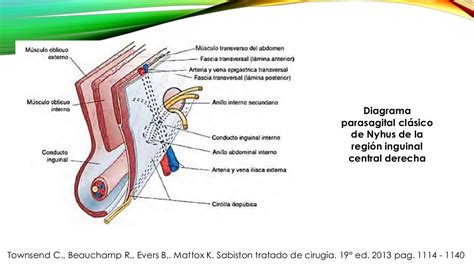 Hernias Inguinales Directas E Indirectas Femorales O Crurales Y Epi