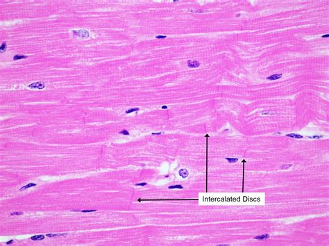 Cardiac Muscle Slide Under Microscope Micropedia