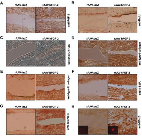 Overexpression And Effects Of RAAV FGF Gene Transfer In Human Adult Download Scientific