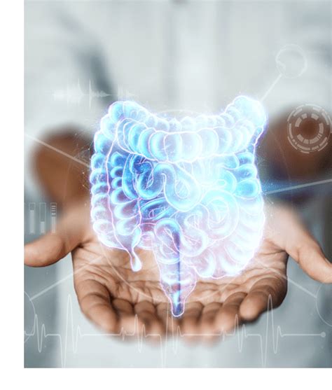 Guides Ulcerative Colitis