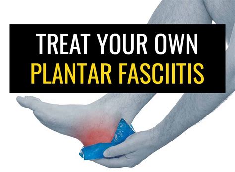 How To Treat Your Own Plantar Fasciitis Sports Injury Physio