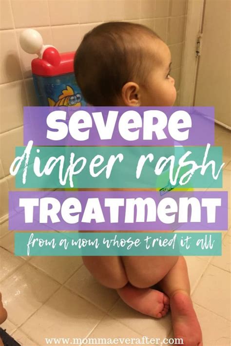 Severe Diaper Rash Treatment From A Mom Whose Tried It All Momma