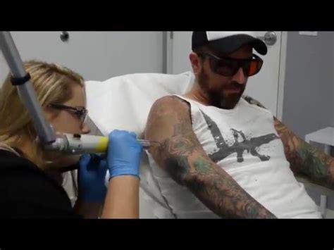 (i wish!) a complete tattoo removal takes a minimum of 2 1/2 years on average, says bethany cirlin, tattoo removal specialist and owner of clean canvas more art. Tattoo Artist Gets Tattoo Removal on Sleeve - First ...
