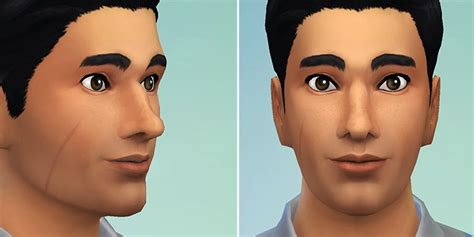 Face Scar Sims 4 Cc Omnibap