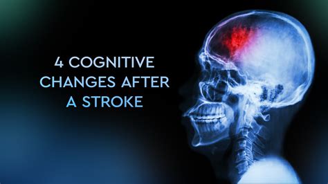 4 Cognitive Changes After A Stroke Happyneuron Pro Blog