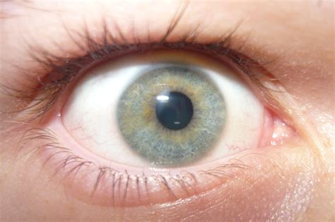 Filelight Blue Eye With Heterochromia