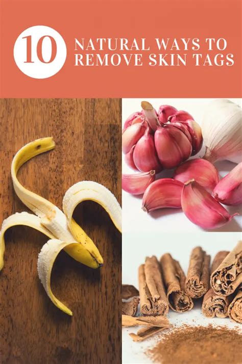 how to remove skin tags naturally happy body formula